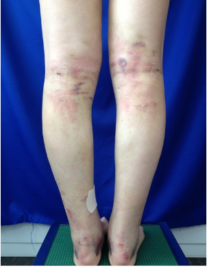 スクリーンショット 2016-07-03 18.21.19