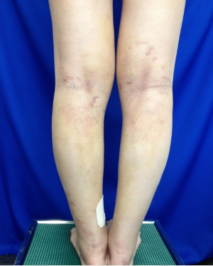 スクリーンショット 2016-07-03 18.21.37