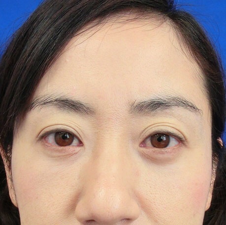 {1B7E6A5F-6E28-434A-A93F-463A401A70EF:01}