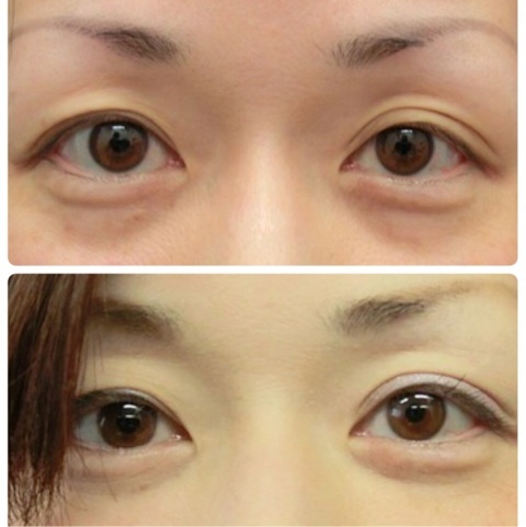 {AE23458D-5F5A-485D-A91C-8AEB72E56D64:01}